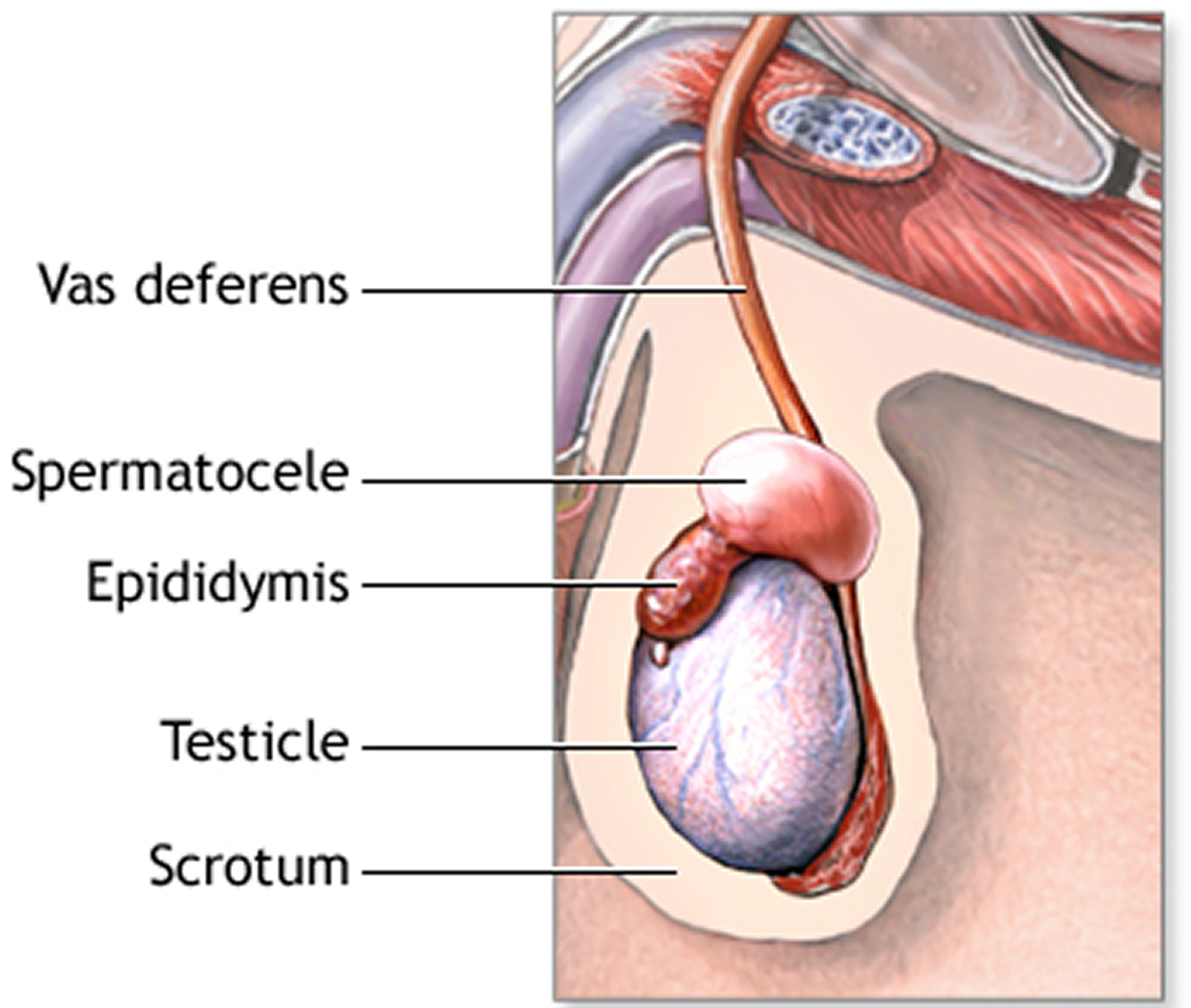 Epididymal sperm aspiration
