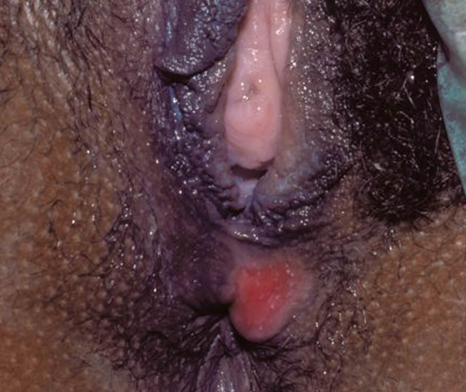 сифилисом можно заразится от мастурбации фото 63