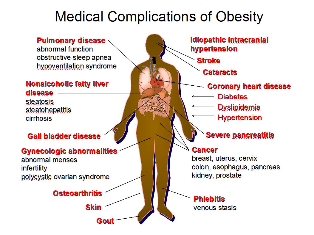 Effects of Obesity