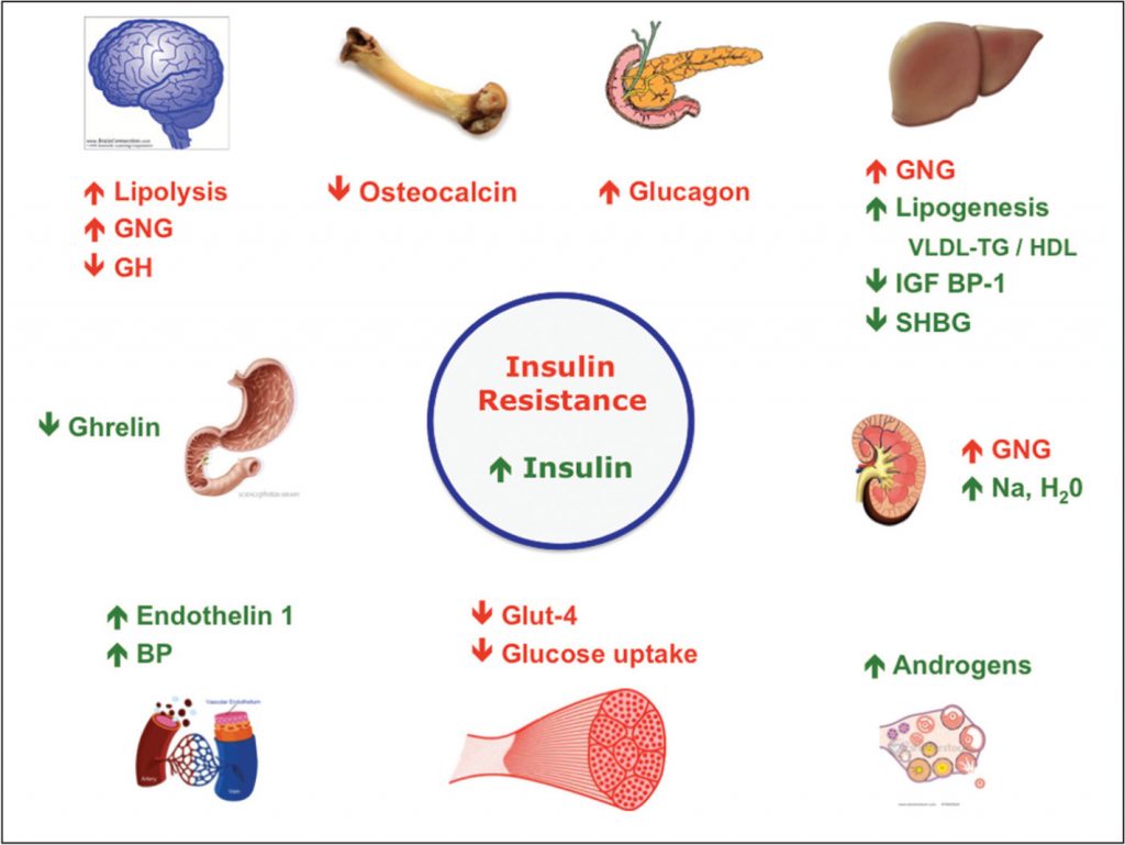 What Is Insulin Resistance? What Causes Insulin Resistance?