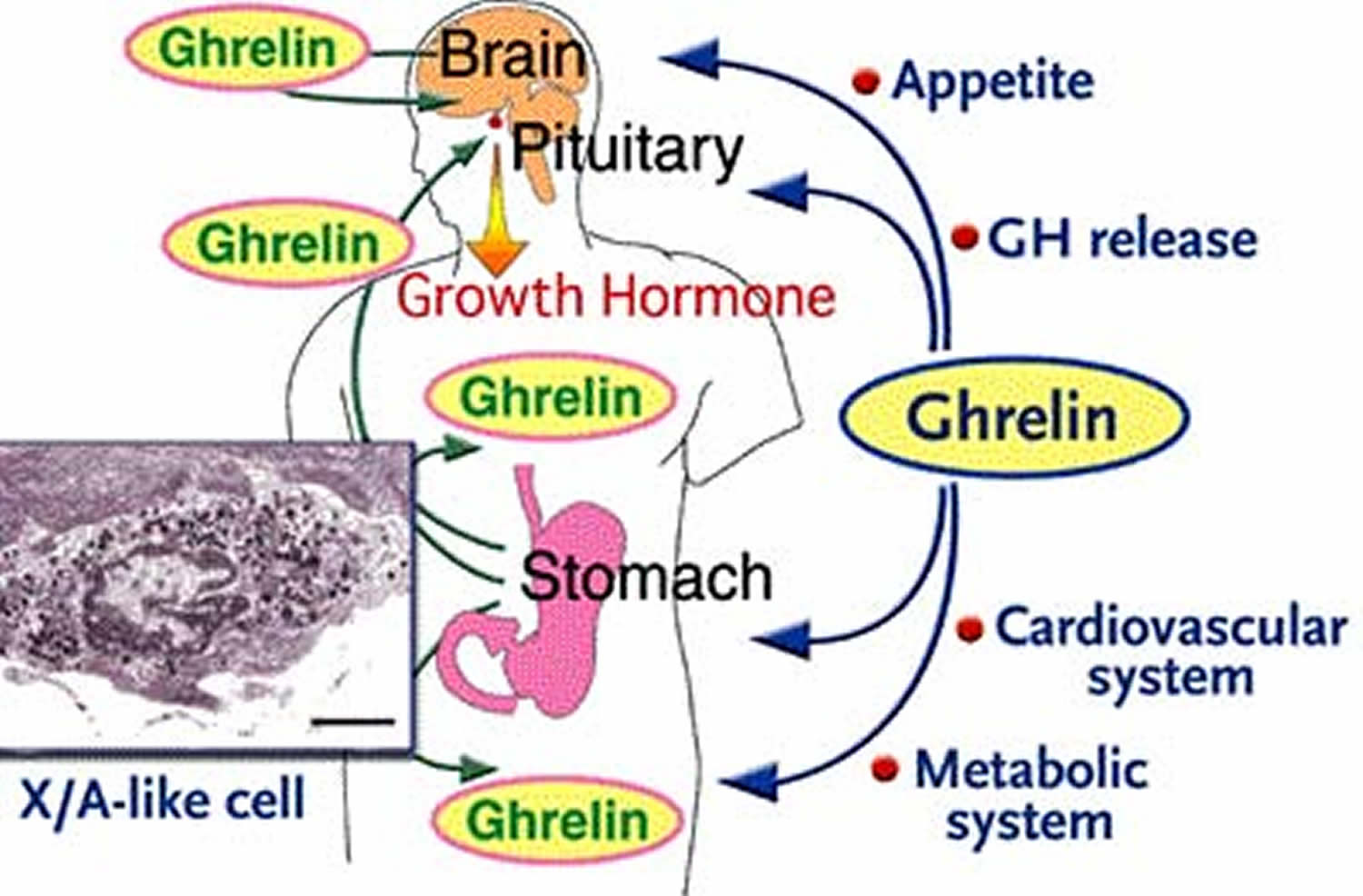 Ghrelin Hormone, the Appetite Stimulant Hormone as a cause of obesity