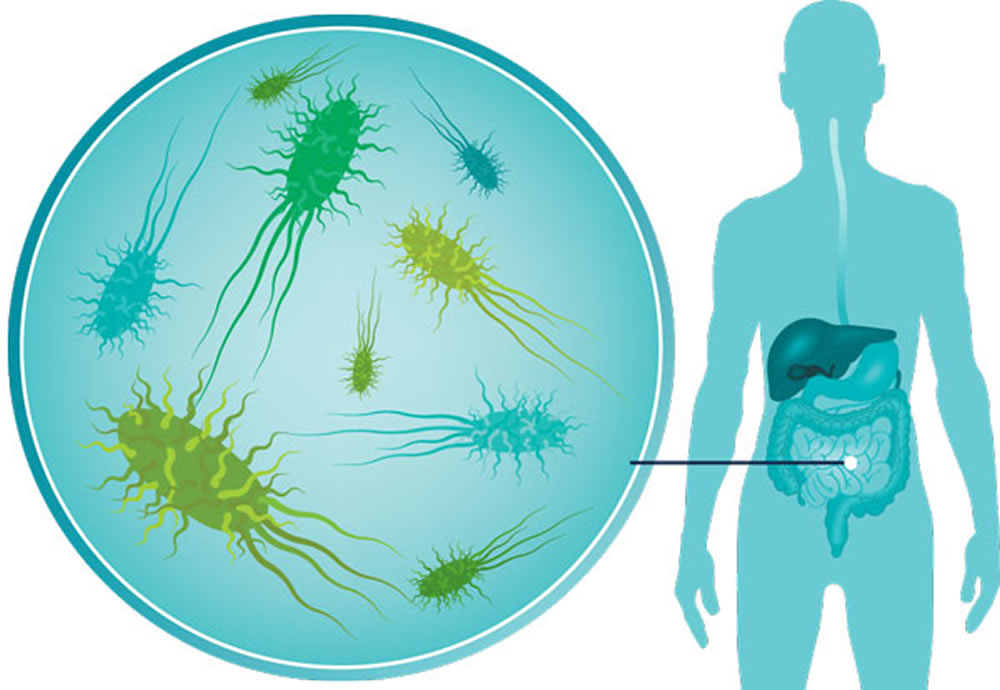 How your Gut Microbiome can cause Obesity, Heart Disease