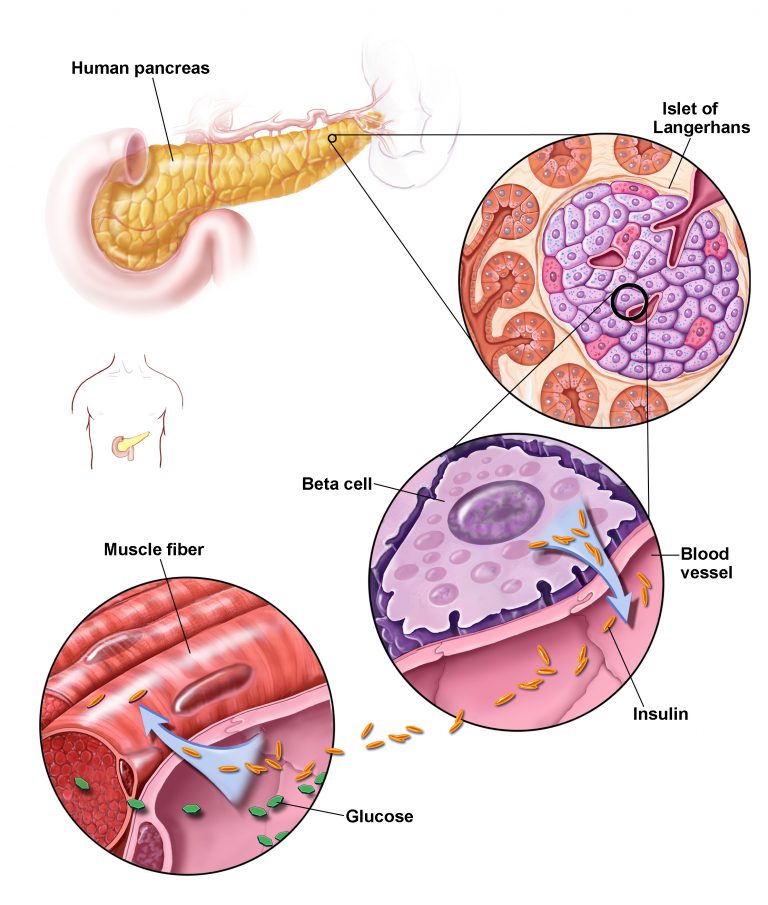 What is Insulin Resistance? What Causes Insulin Resistance?