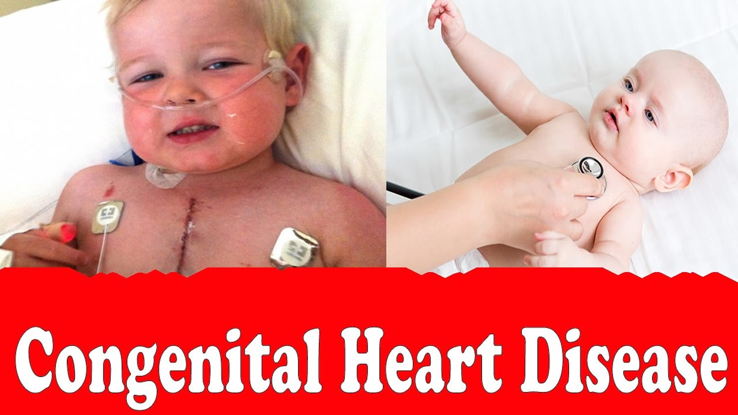 congenital heart disease
