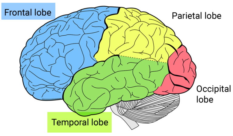 What Is Frontotemporal Dementia Or Frontotemporal Lobar Degeneration?