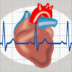 heart arrhythmia