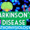 parkinson’s disease