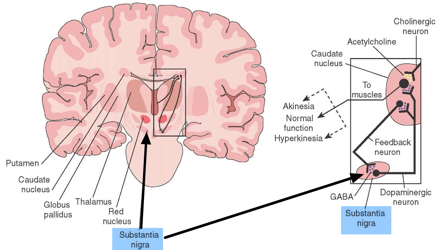 What is Parkinson's Disease - Causes, Signs, Symptoms and Treatments