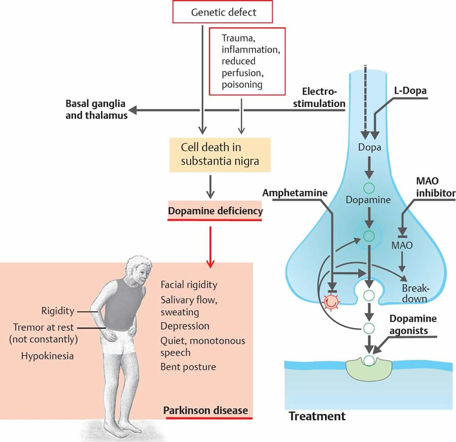 Parkinsons And Dopamine Impaired Dopamine Metabolism In Parkinsons