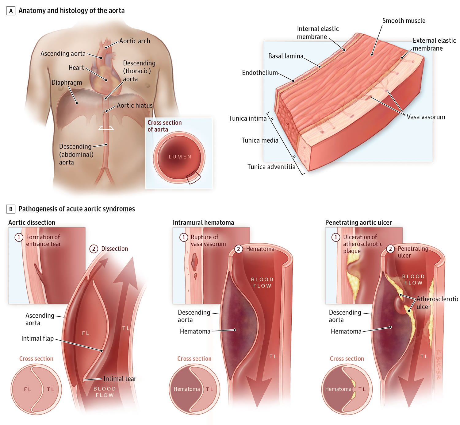 Heart Pain Sharp Heart Pain Causes Symptoms Treatment
