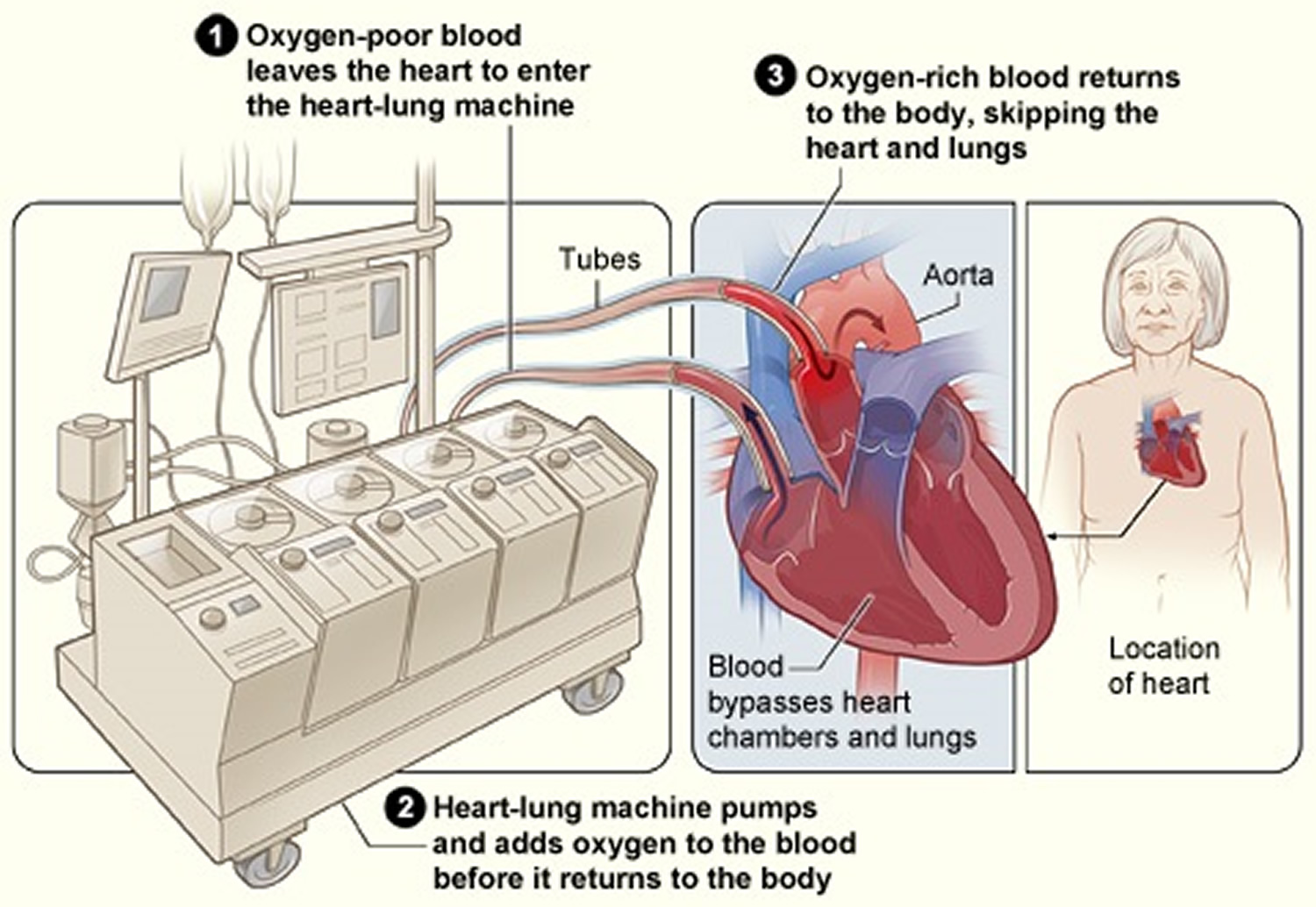 heart-surgery-types-open-bypass-ablation-heart-valve-surgery