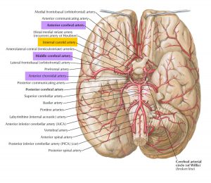 Moyamoya Disease - Causes, Symptoms, Life Expectancy, Treatment