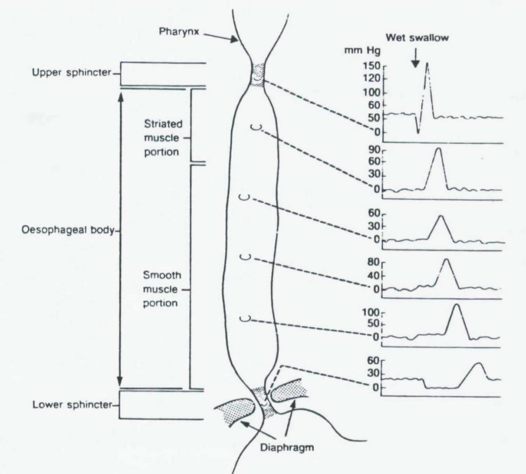 Nutcracker Esophagus - Symptoms, Diagnosis And Treatment