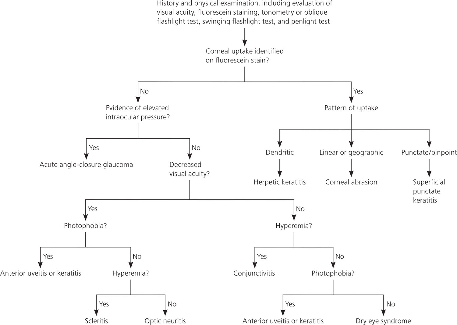 diagnosing causes of eye pain