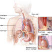 esophagus pain