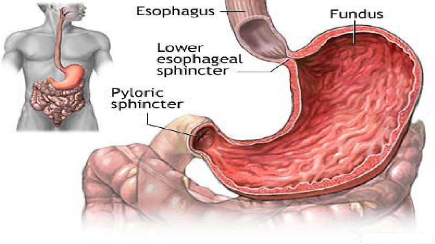 lower esophageal sphincter