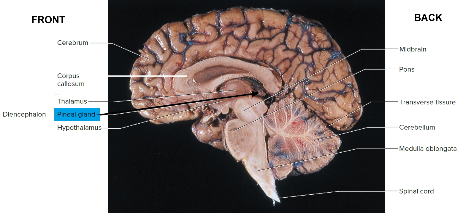 What Is The Pineal Gland Simple Definition