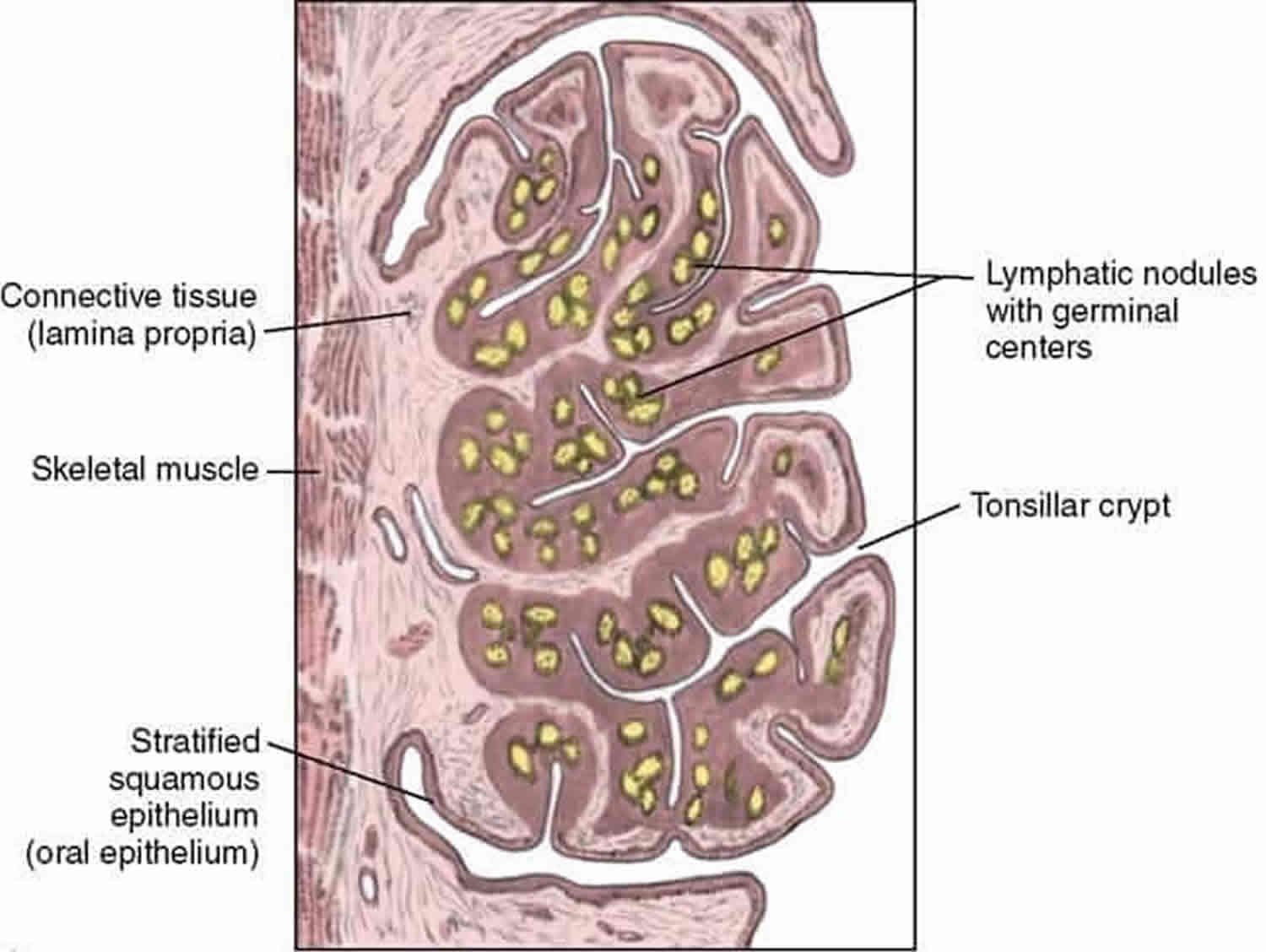 Tonsil stones causes, symptoms, diagnosis and tonsil stones treatment