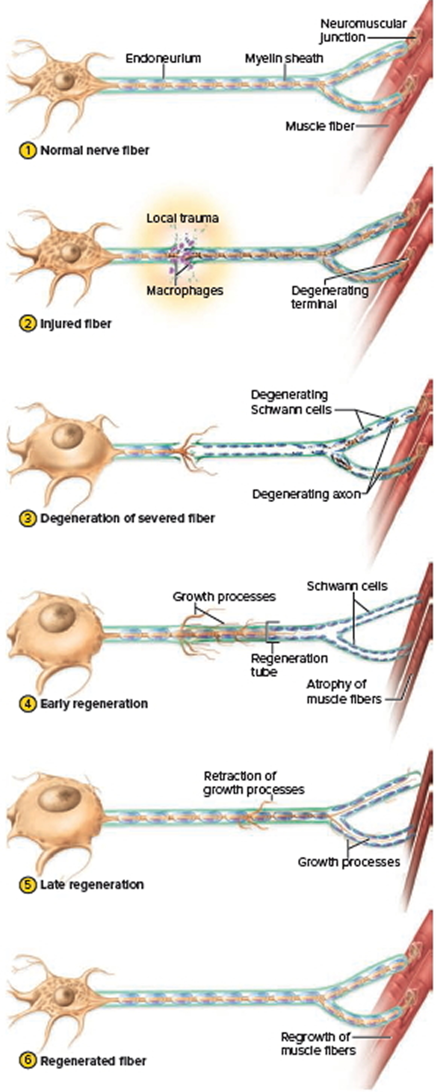 Regeneration of a Damaged Nerve Fiber