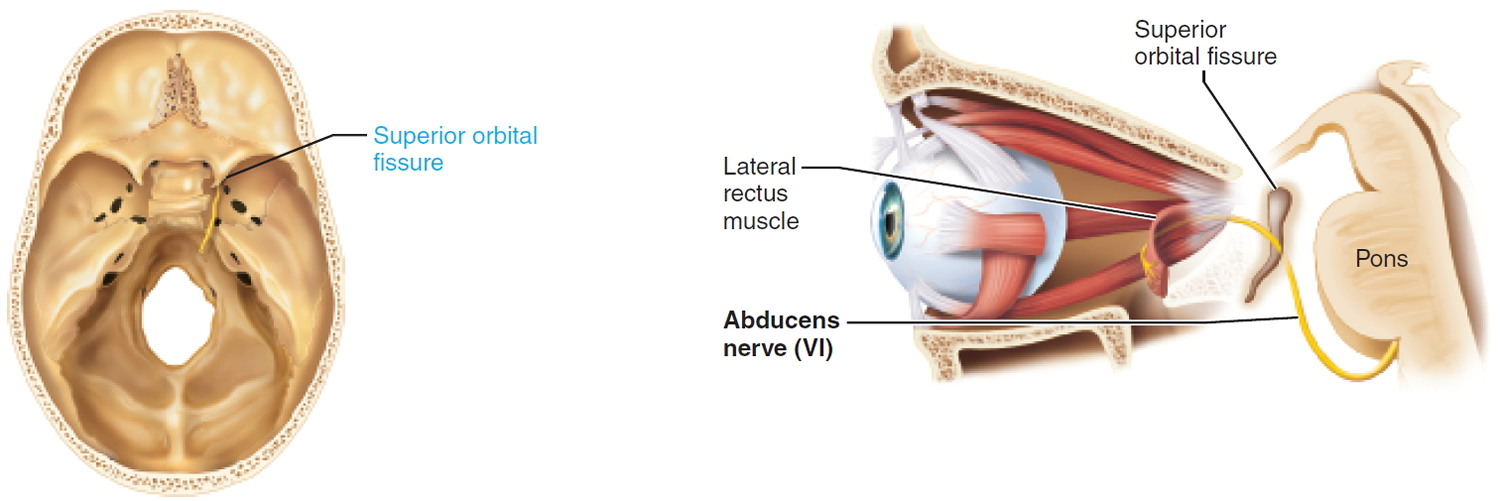 abducens nerve - cranial nerve 6