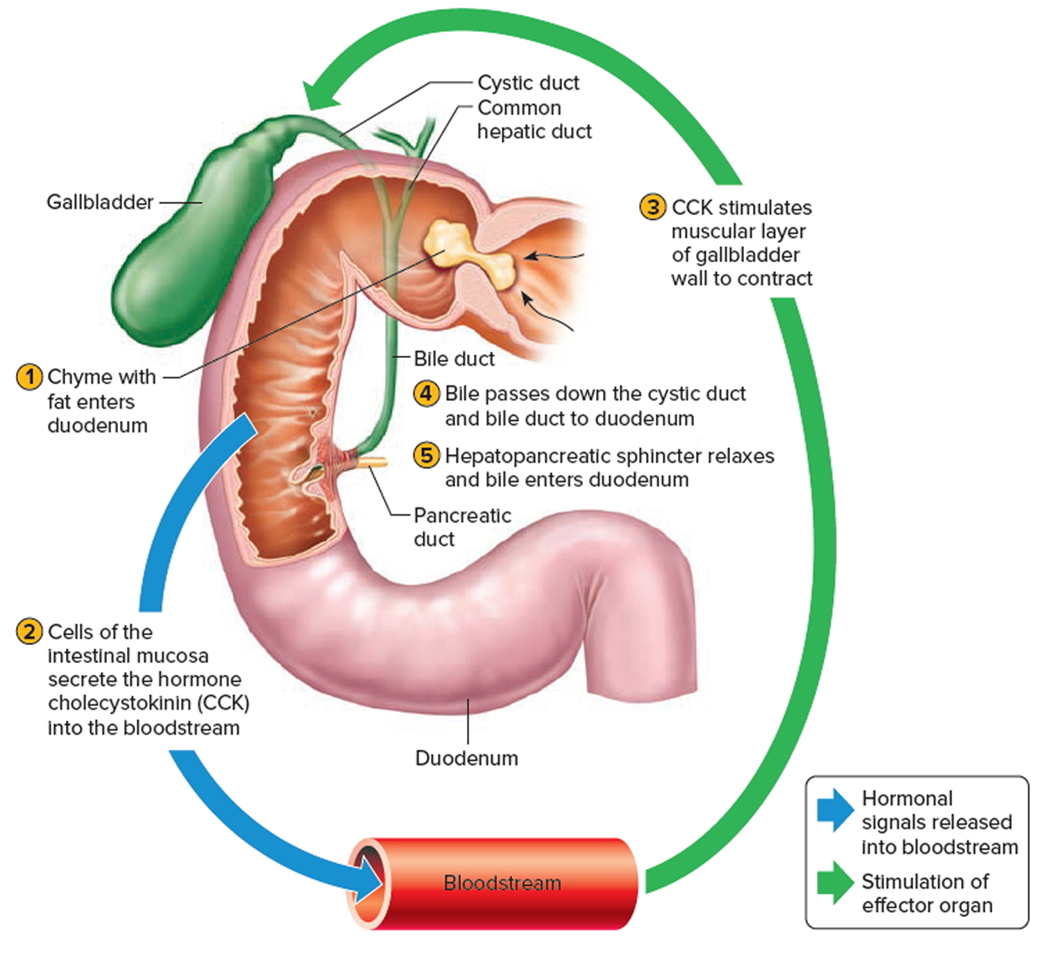 cholecystectomy-gallbladder-removal-surgery-recovery-side-effects