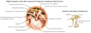 Ear Drum Anatomy, Causes, Diagnosis & Treatment for Busted Ear Drum