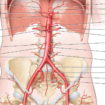 iliac artery