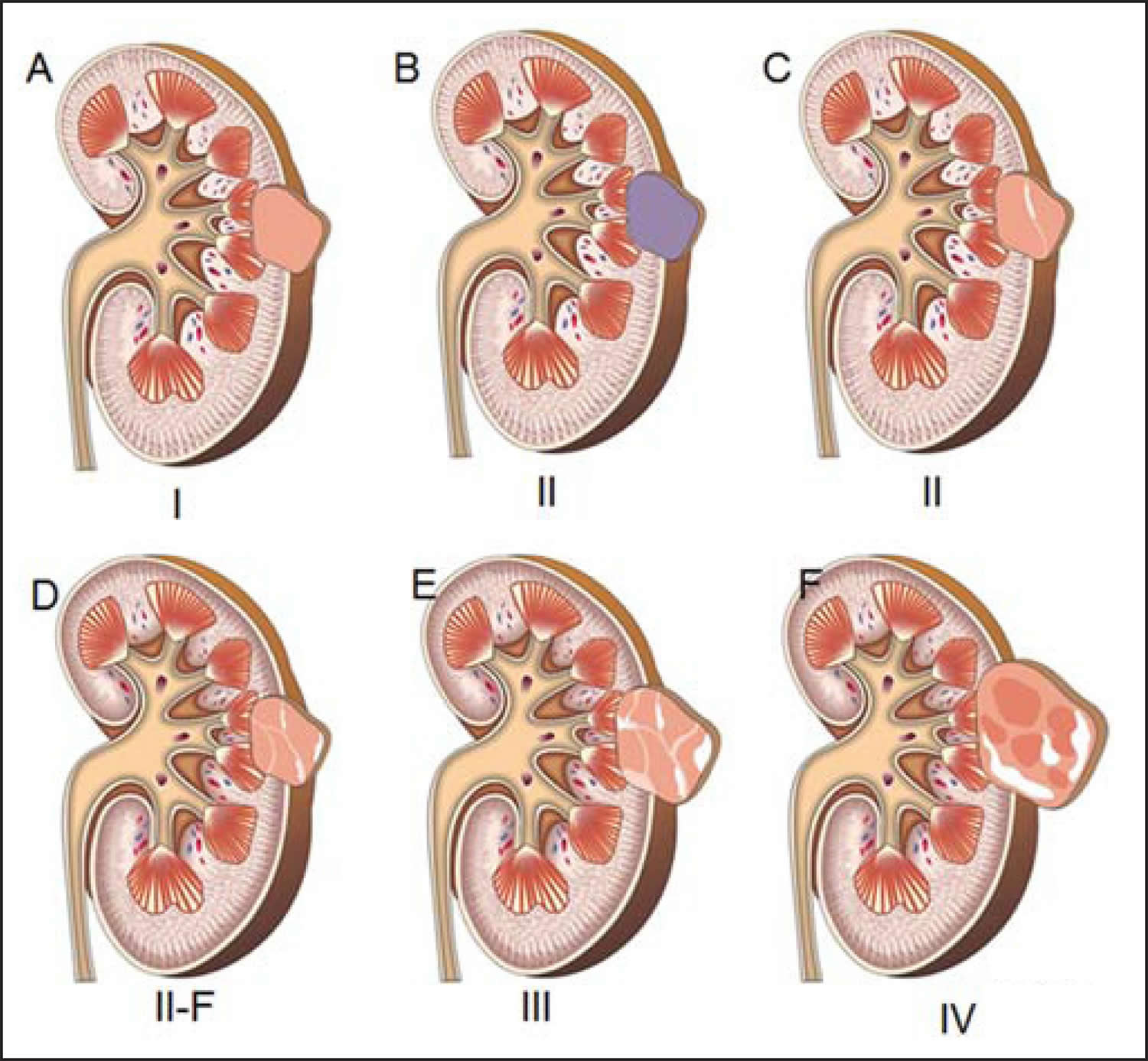 Is A 4 Cm Cyst Big