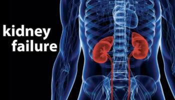 kidney failure