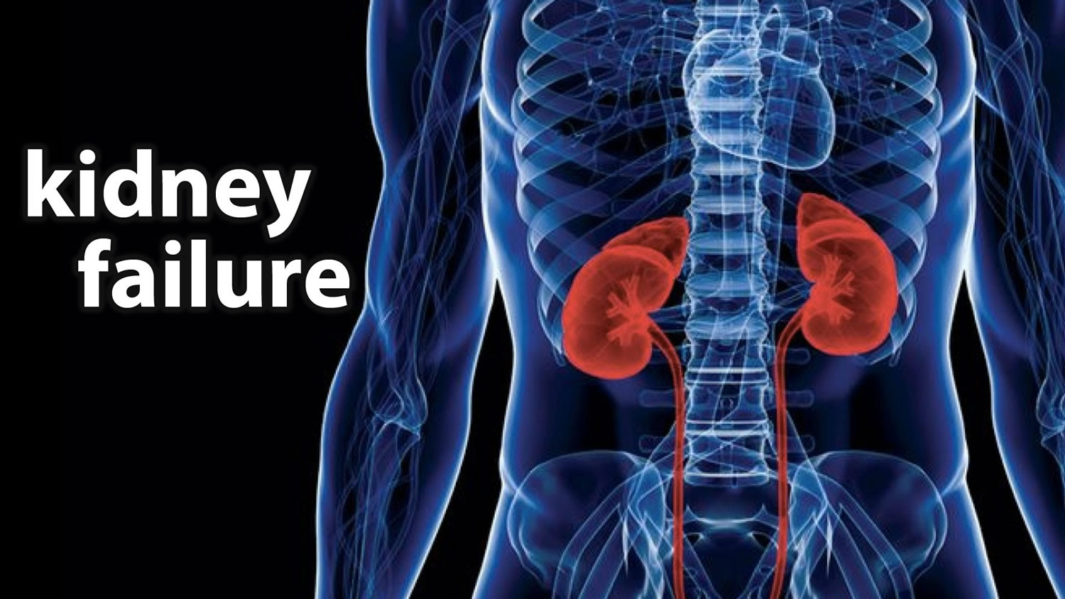 What Causes Kidney To Failure