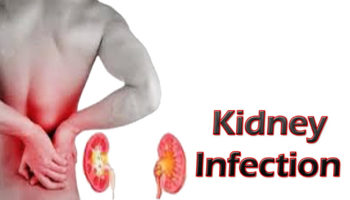 kidney infection