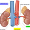 renal artery