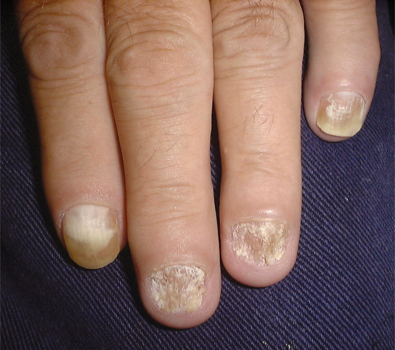 sandpaper nails