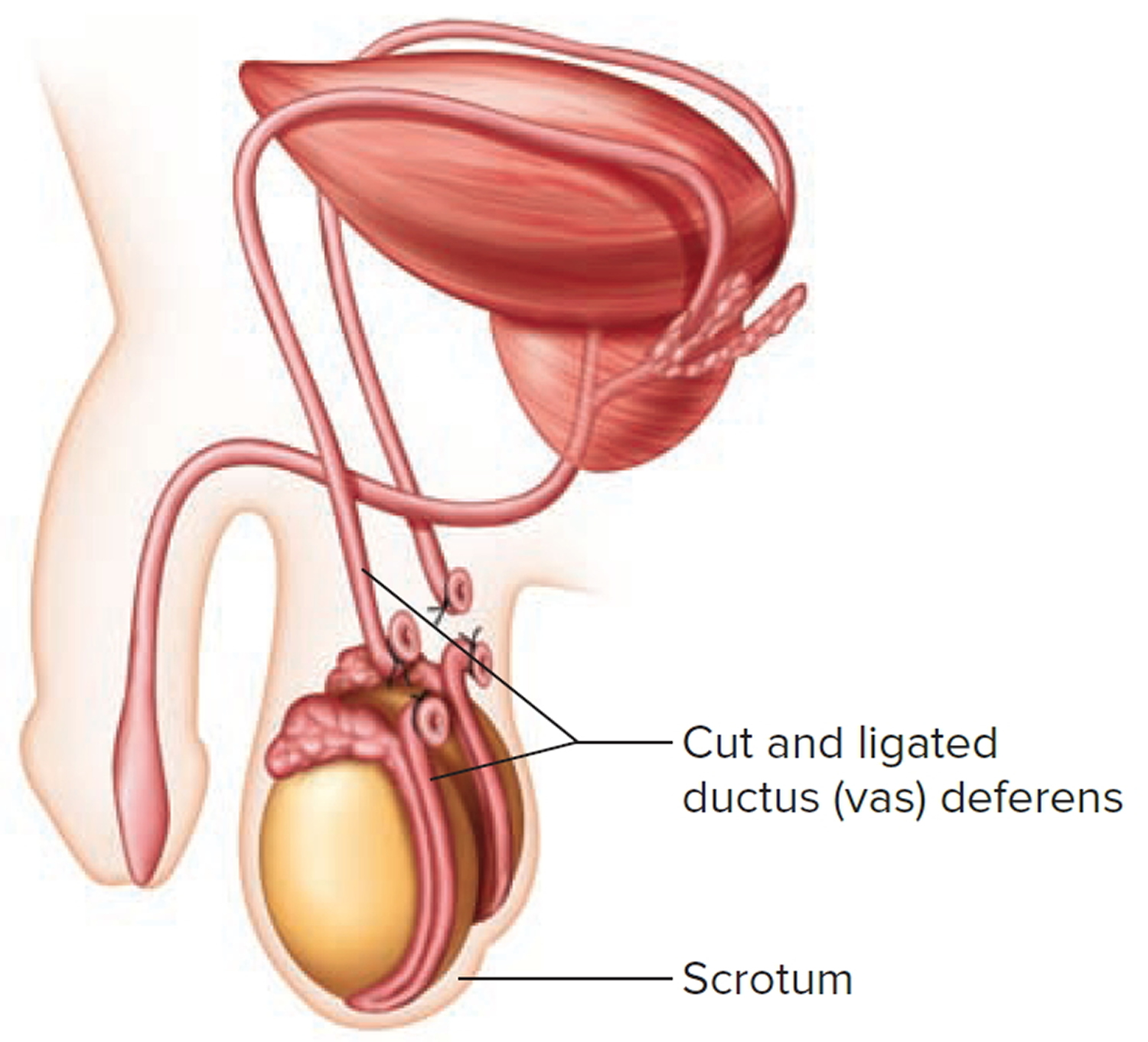 spermatic cord and vas deferens