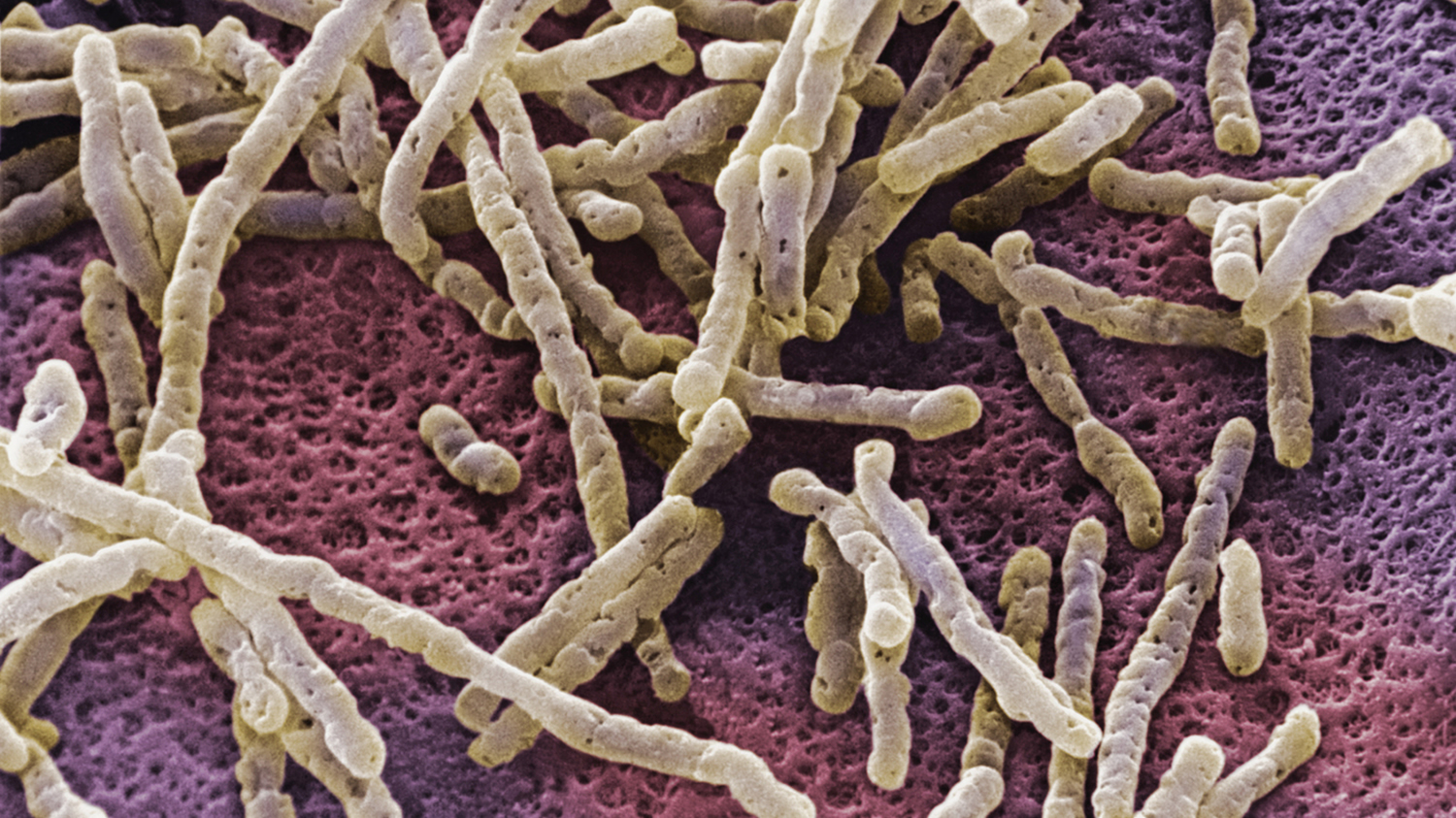 Clostridium difficile