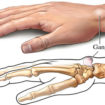 Ligaments - Thumb, Shoulder, Elbow, Hip, Knee and Ankle Ligaments