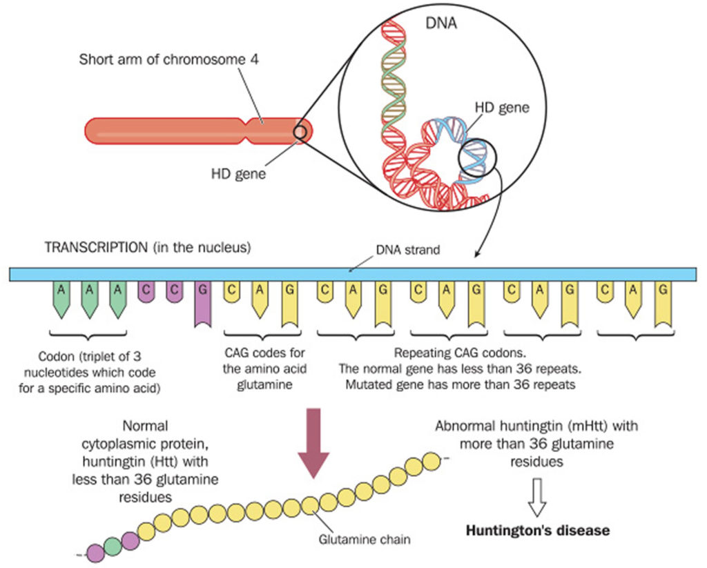 Huntington's Disease Causes, Symptoms, Diagnosis and Treatment