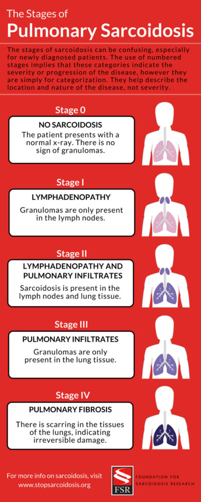 Sarcoidosis - Causes, Stage, Signs, Symptoms, Diagnosis & Treatment