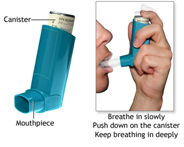 Asthma Attack Causes, Allergy, Triggers - Symptoms, Treatment Inhalers