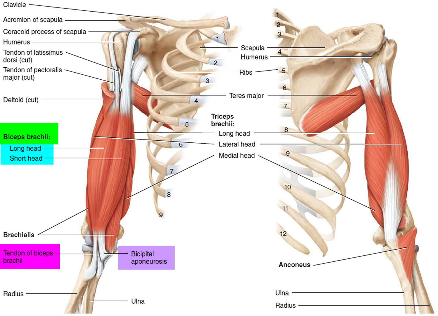 biceps tendinitis