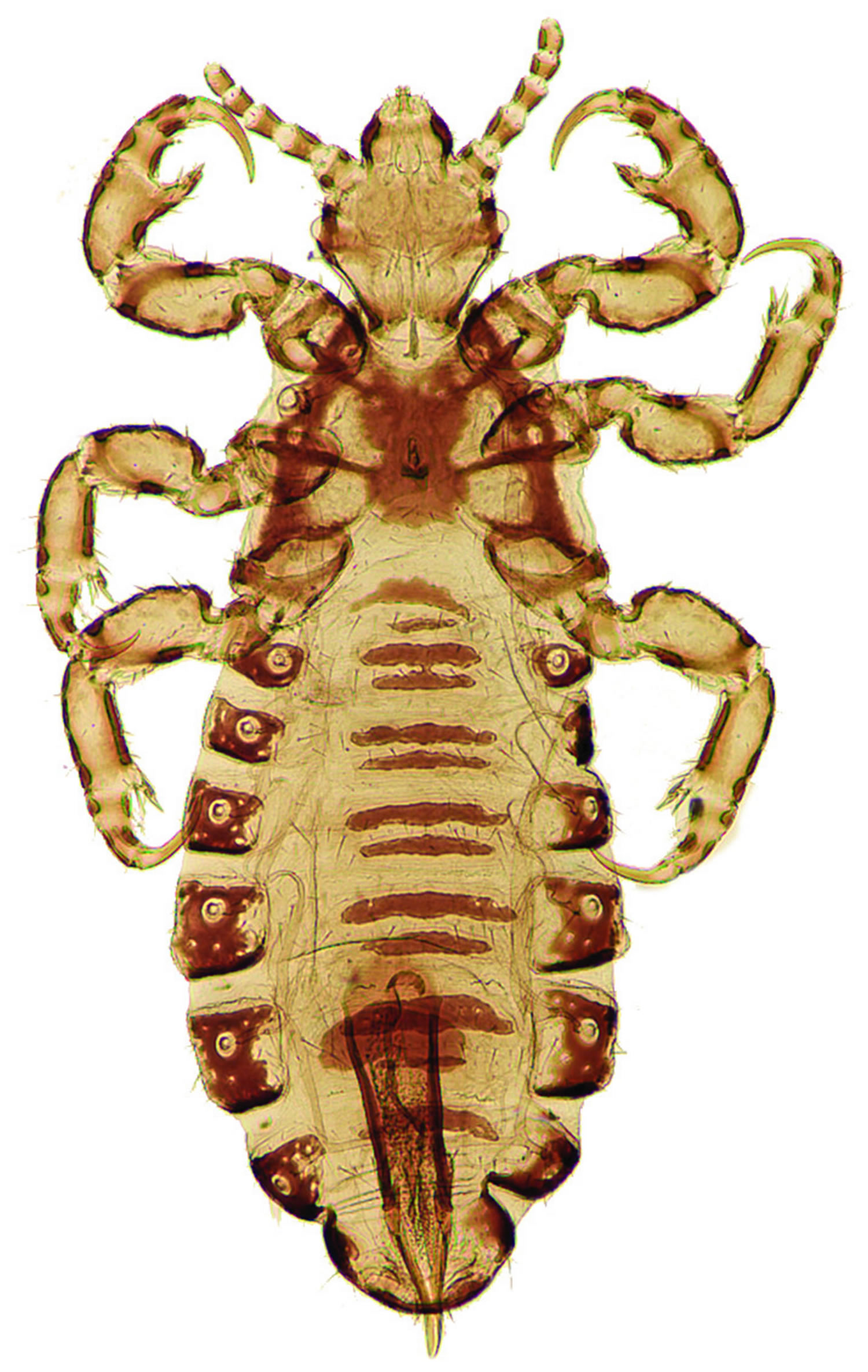 Head Louse