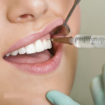 local anesthesia