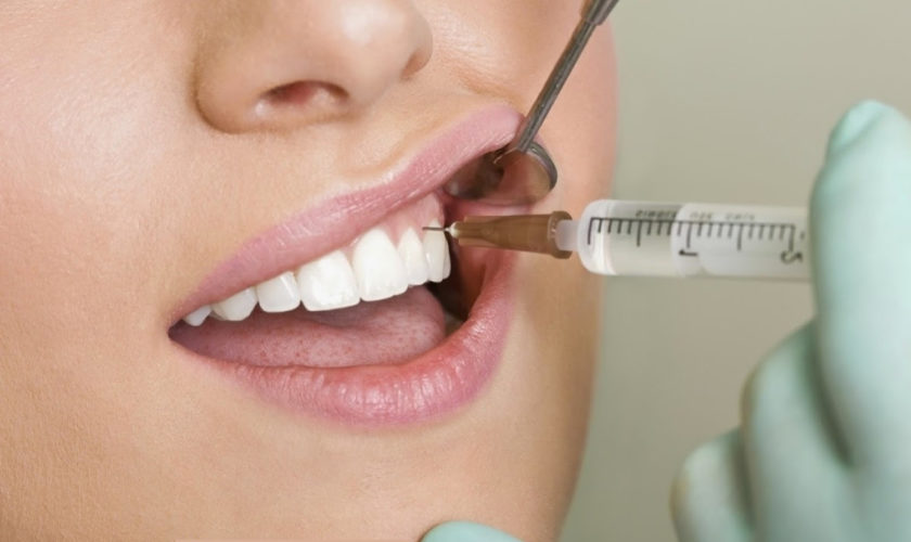 local anesthesia