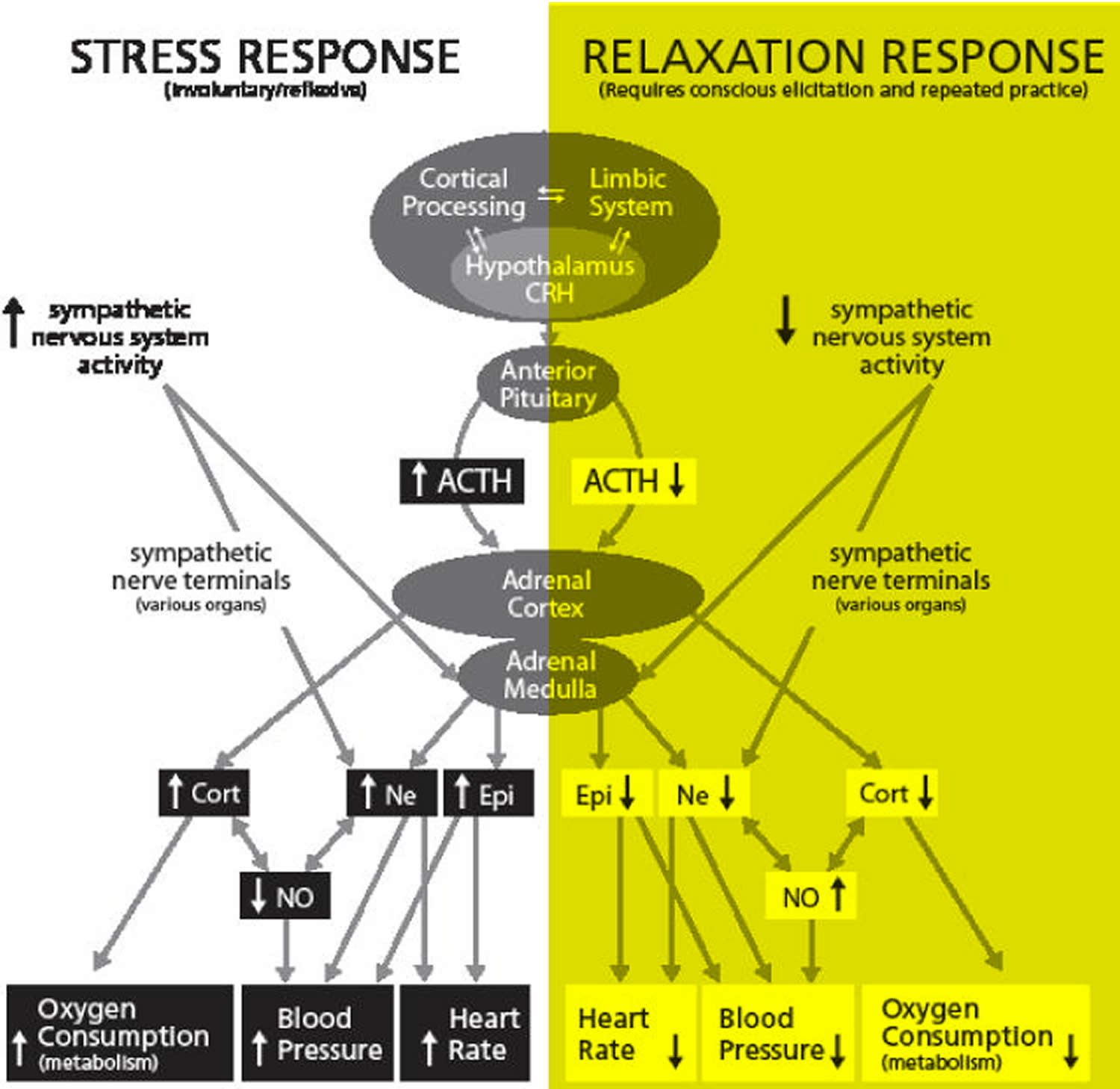 relaxation response