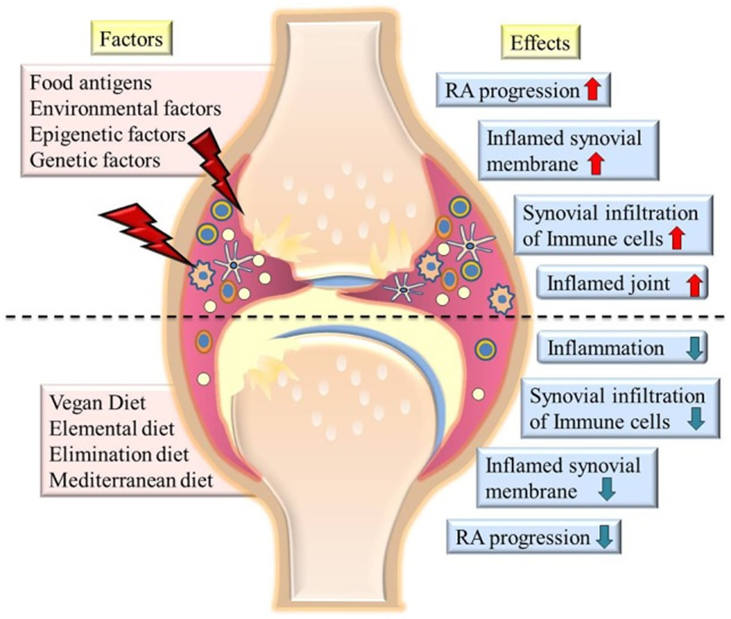 Factors contributing to severity of rheumatoid arthritis