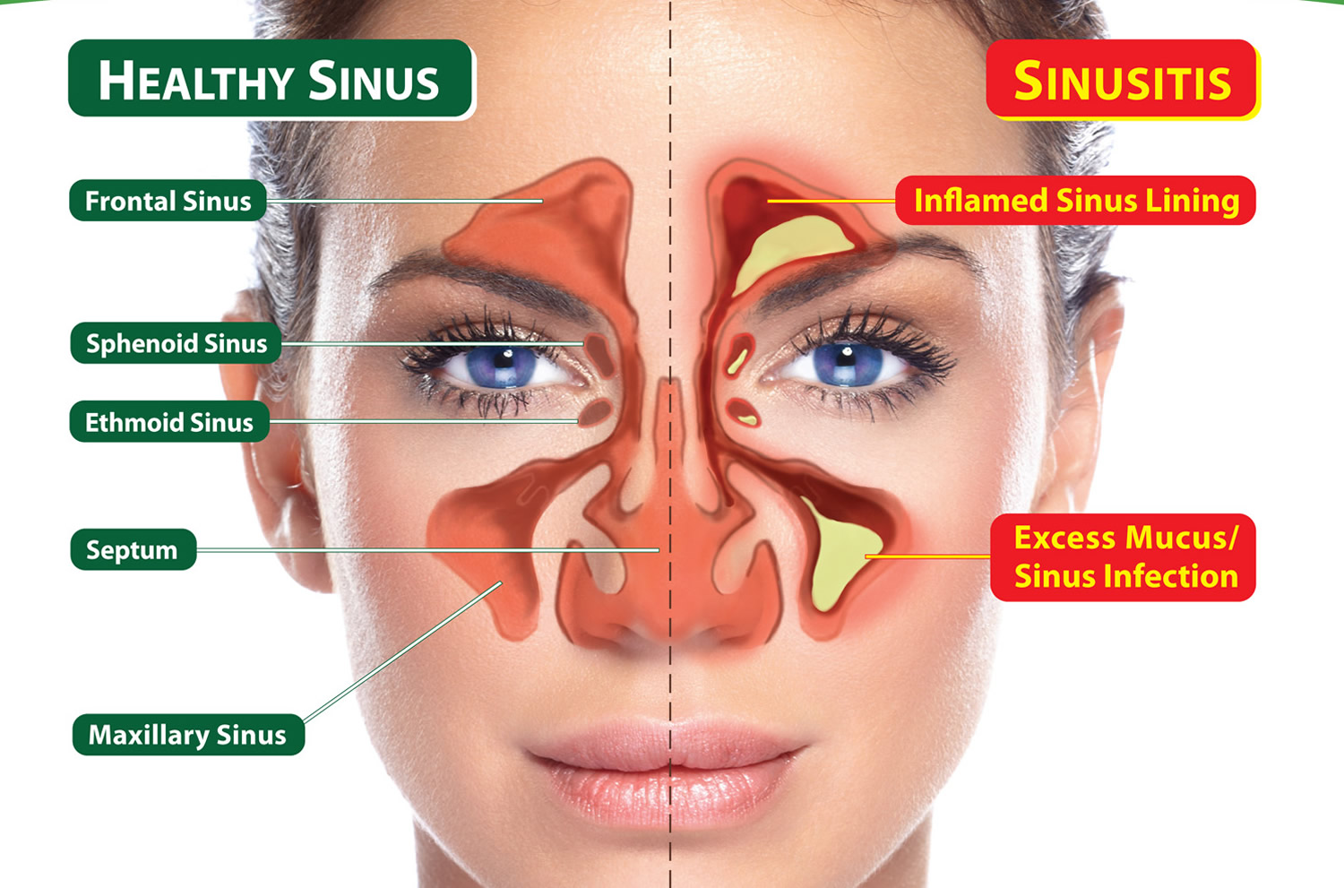 sinus pain diving