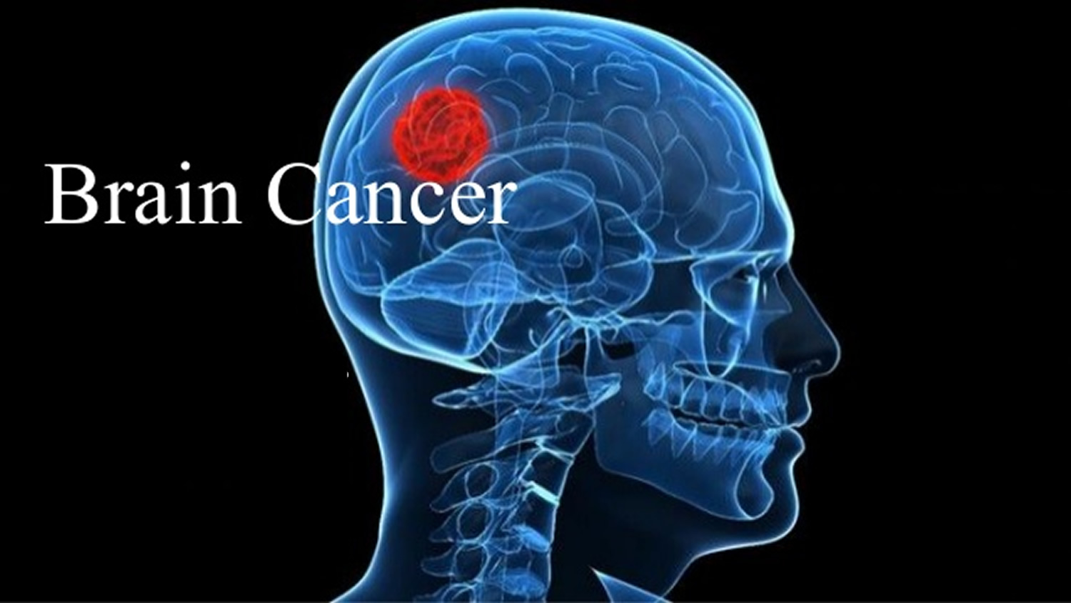 can you travel with brain cancer