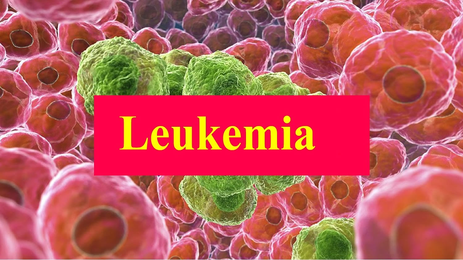 leukemia-causes-symptom-signs-diagnosis-prognosis-and-treatment