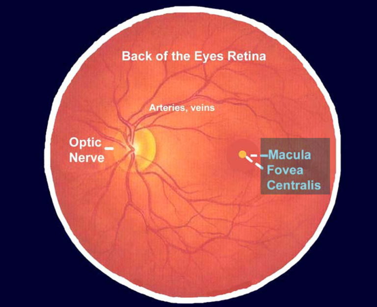 macular-degeneration-age-related-causes-types-symptoms-treatment