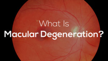 macular degeneration